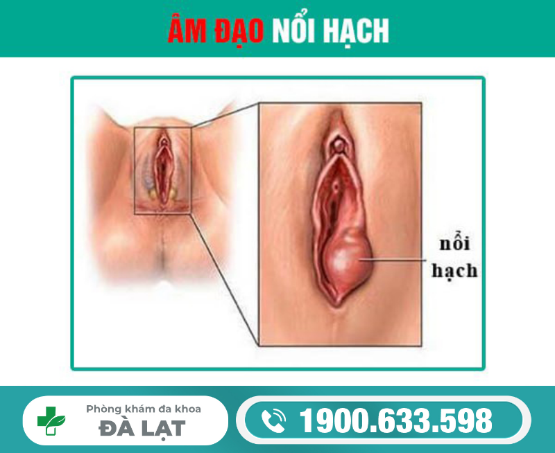 Hình ảnh minh họa